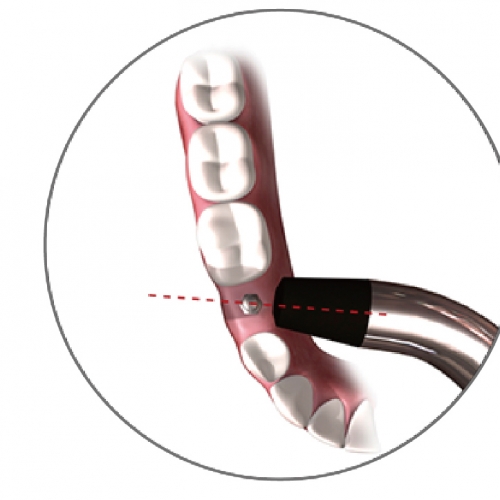 W&H 1015